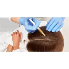 Мезотерапия волосистой части головы(лечение выпадения) Hair-X 5ml