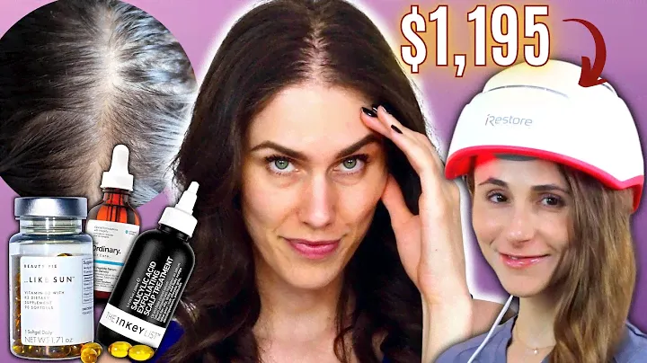 What I'm Doing About My Hair Loss…