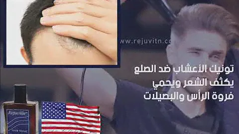 تخلص من الصلع المبكر بسبب تساقط الشعر بفضل تونيك ريجوفيل