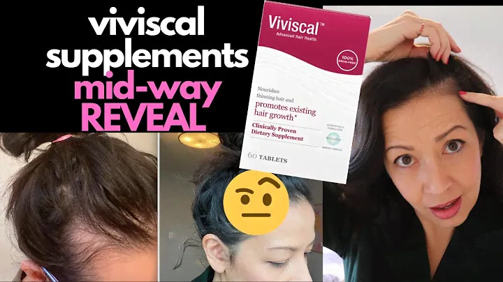 i'm halfway through testing Viviscal Supplements | HAIR LOSS SUFFERER REVIEW, 45 DAY BEFORE AFTER