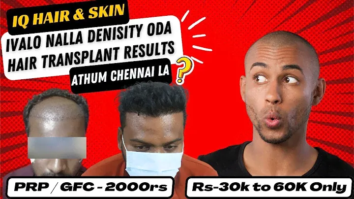 IQ HAIR TRANSPLANT AND SKIN CARE CLINIC