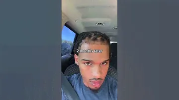 @keith_lee125 hair growth journey with Miracle Drops. It’s a 10/10! #kaleidoscopehairproducts #locs