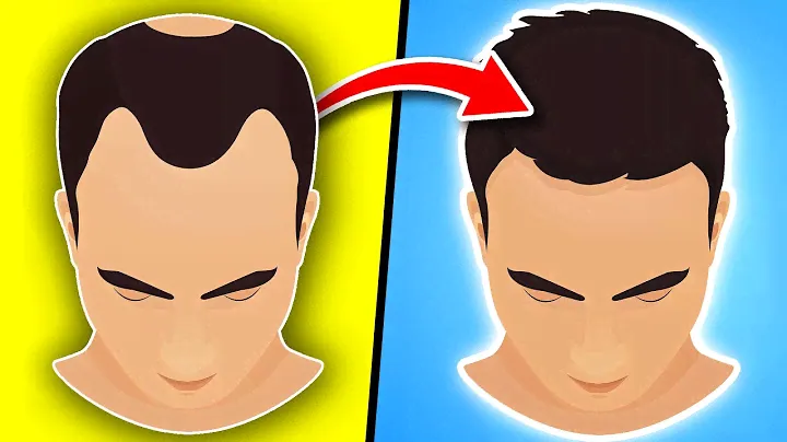 Men: 10 Things You MUST Start To Naturally Regrow Your Hair