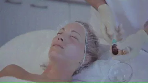 Fusion Fractional Meso - Face