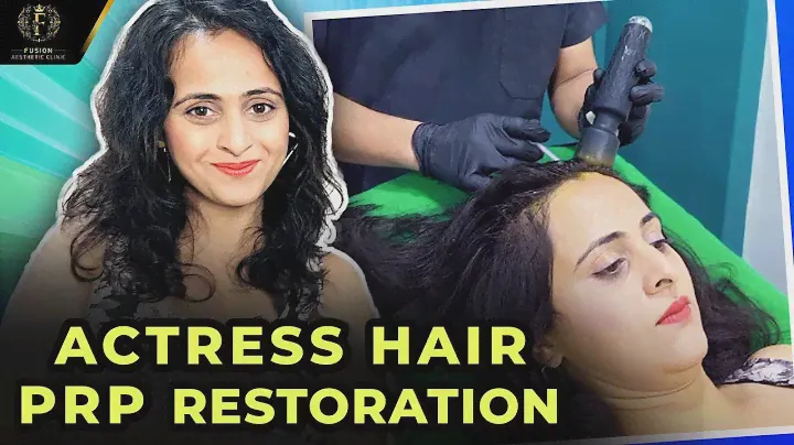 Sai Ranade Hair Prp Treatment | PRP | Hairloss Treatment | Dr. Pranil More