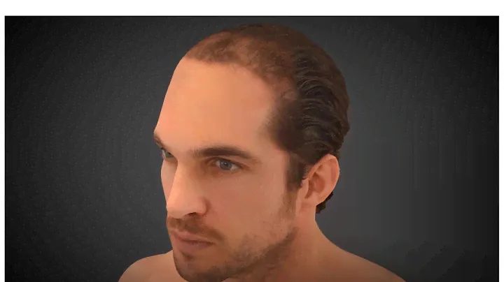 DR CYJ HAIR FILLER