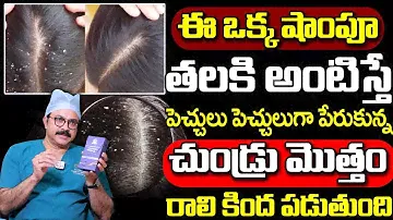 Solution for Dandruff | Get Rid of Dandruff | Anti - Dandruff Shampoo | Prismos Beauty Products