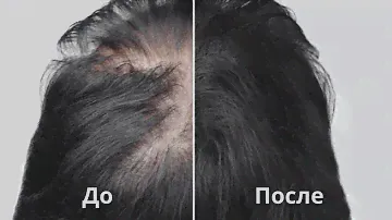 Уход за волосами настоем цикория! В июле для роста и густоты волос!