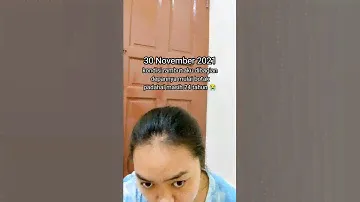 Obat Penumbuh Rambut RACUN TIKTOK | RACUN SHOPEE HAUL | RACUN SHOPEE | REKOMENDASI SHOPEE