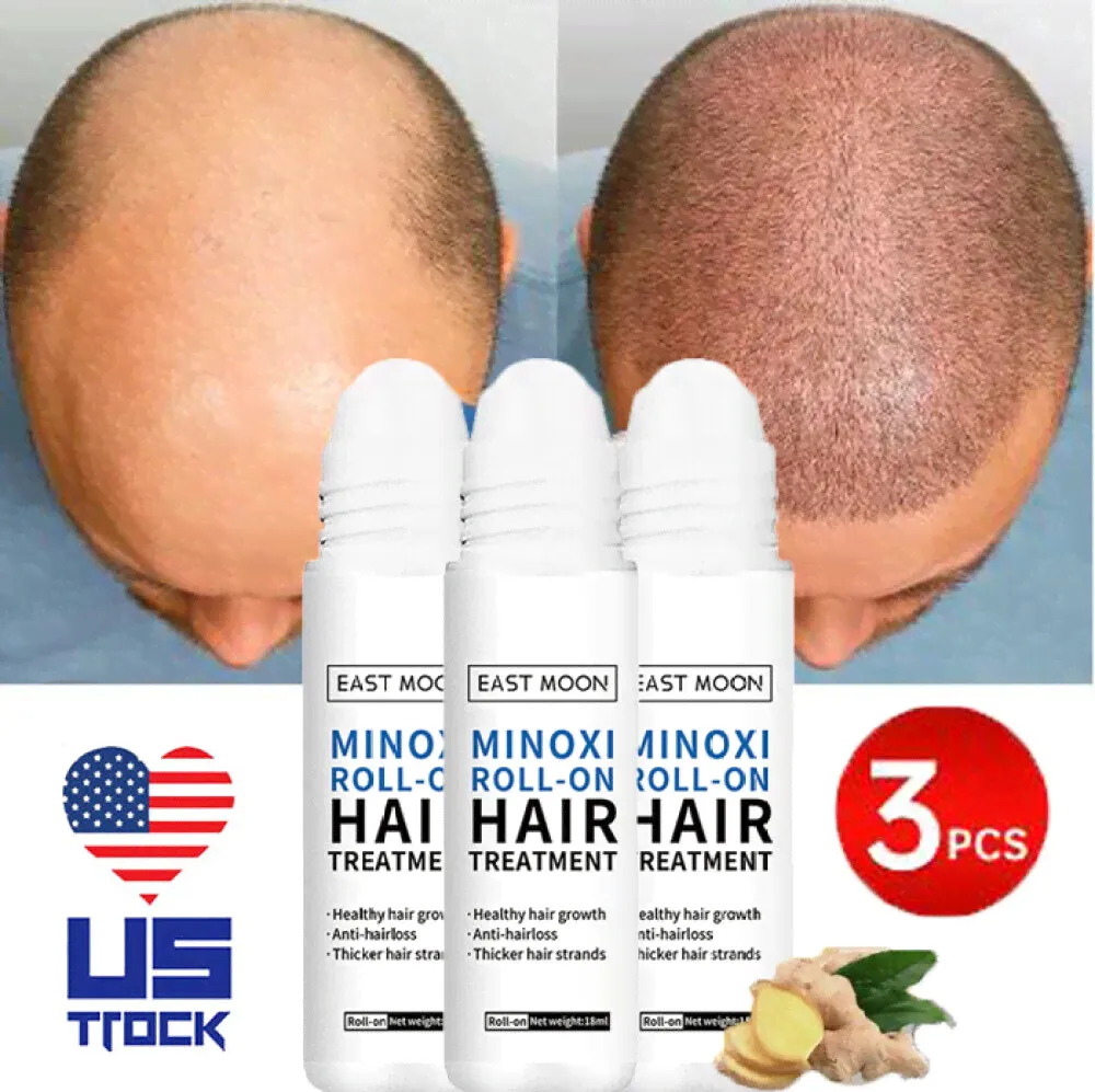 3Growth Roll-on Hair Treatment Extra Strength hair growth serum Regrowth fr Men