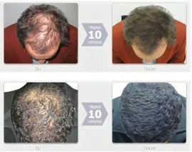 Загуститель волос EcoSapiens I Love Hair русый